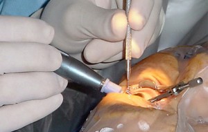 Cosmetic Dentist San Mateo